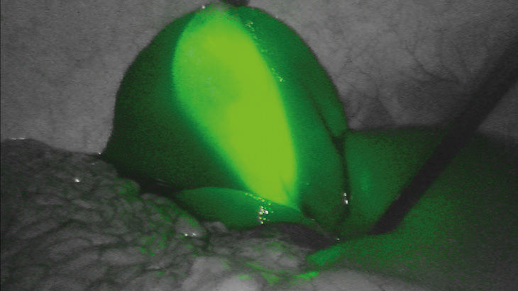 FI vert – Technologie d’imagerie par fluorescence 3D